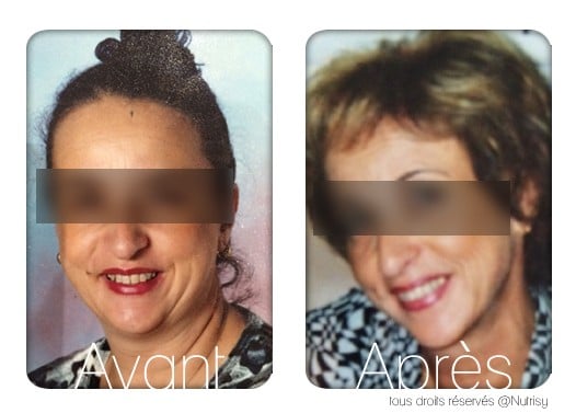 Francine, 64 ans -11kg en 3 mois